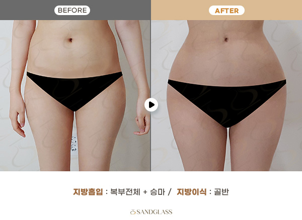 a84da347c80f5b8413ffd57bce47fc92_1764214473_8036.jpg a84da347c80f5b8413ffd57bce47fc92_1764214473_8036.jpg