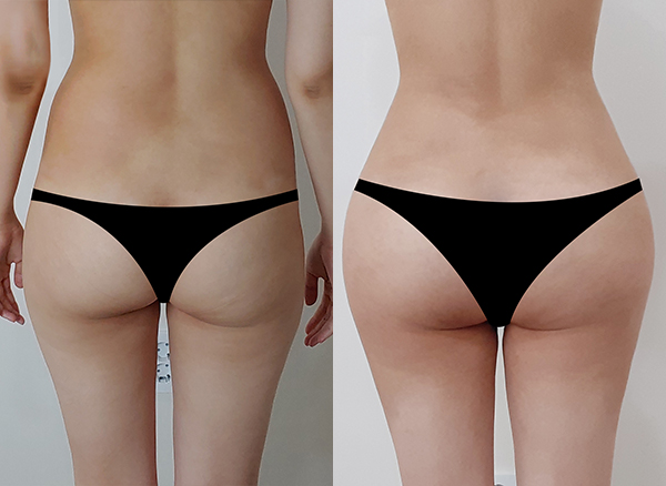 a84da347c80f5b8413ffd57bce47fc92_1764214474_6301.jpg a84da347c80f5b8413ffd57bce47fc92_1764214474_6301.jpg