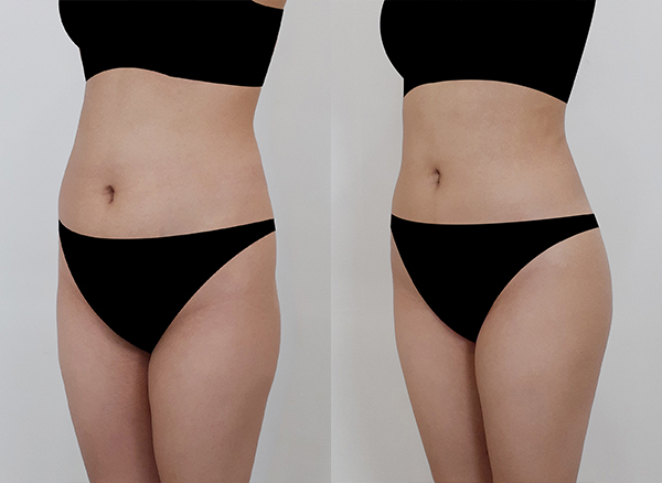 0daf08d6d81f2105f2d10aeb5a8bbca2_1764824810_9276.jpg 0daf08d6d81f2105f2d10aeb5a8bbca2_1764824810_9276.jpg