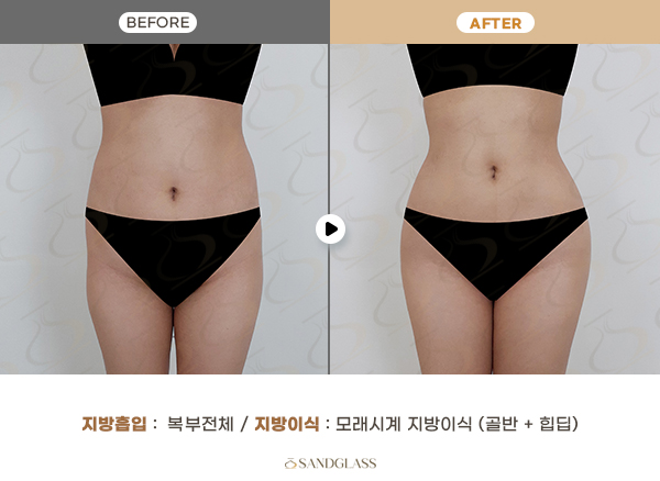 0daf08d6d81f2105f2d10aeb5a8bbca2_1764824811_3329.jpg 0daf08d6d81f2105f2d10aeb5a8bbca2_1764824811_3329.jpg