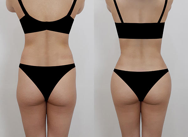 0daf08d6d81f2105f2d10aeb5a8bbca2_1764824812_1348.jpg 0daf08d6d81f2105f2d10aeb5a8bbca2_1764824812_1348.jpg