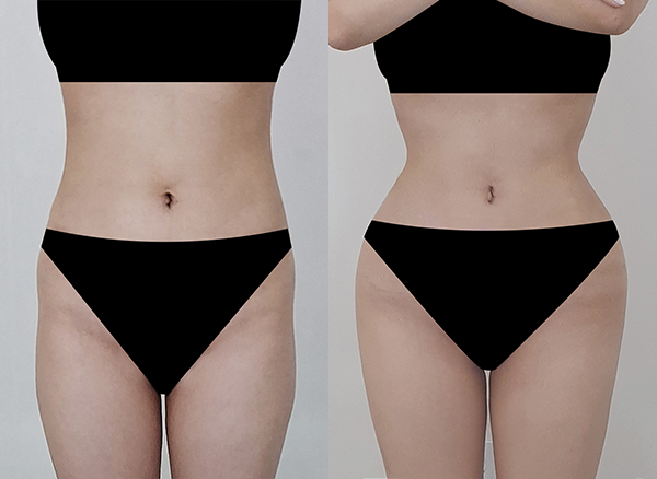 2cfa0d7976c185d4ef529ef44b82c0f8_1768879128_6719.jpg 2cfa0d7976c185d4ef529ef44b82c0f8_1768879128_6719.jpg