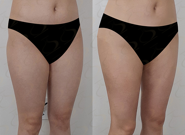 34b079997b931a995d2ffed73ade5fab_1769567619_3645.jpg 34b079997b931a995d2ffed73ade5fab_1769567619_3645.jpg