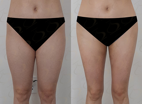 34b079997b931a995d2ffed73ade5fab_1769567620_1786.jpg 34b079997b931a995d2ffed73ade5fab_1769567620_1786.jpg