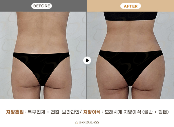 6d4201aa464294c7bad158ec548ee278_1768440706_0925.jpg 6d4201aa464294c7bad158ec548ee278_1768440706_0925.jpg