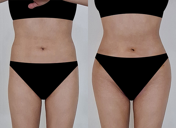 6d4201aa464294c7bad158ec548ee278_1768440706_4863.jpg 6d4201aa464294c7bad158ec548ee278_1768440706_4863.jpg