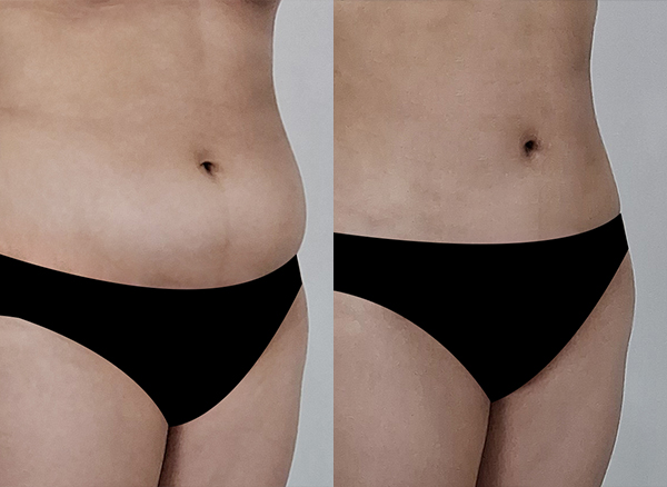 6d4201aa464294c7bad158ec548ee278_1768441283_1557.jpg 6d4201aa464294c7bad158ec548ee278_1768441283_1557.jpg