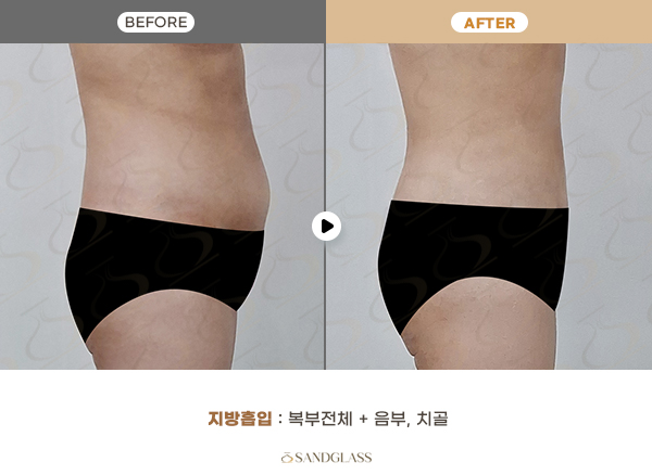 6d4201aa464294c7bad158ec548ee278_1768441283_5368.jpg 6d4201aa464294c7bad158ec548ee278_1768441283_5368.jpg