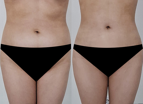 6d4201aa464294c7bad158ec548ee278_1768441283_8803.jpg 6d4201aa464294c7bad158ec548ee278_1768441283_8803.jpg