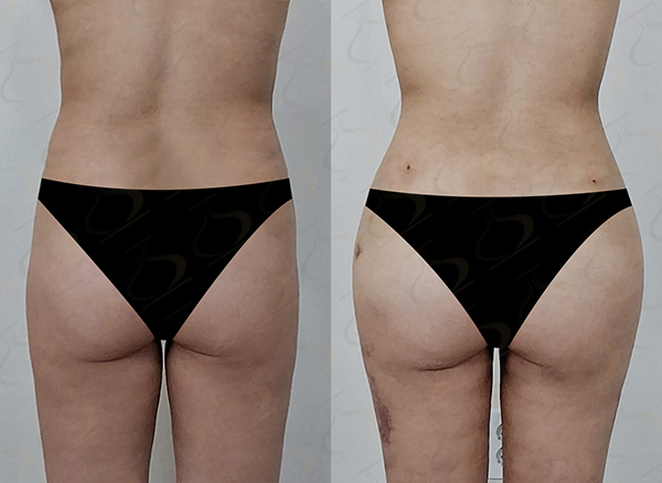 7225587266a062e7b6890afc36f102f4_1769752113_3091.jpg 7225587266a062e7b6890afc36f102f4_1769752113_3091.jpg