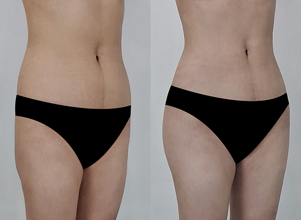 90821425e516db8fe4febe9856dd0016_1767925244_67.jpg 90821425e516db8fe4febe9856dd0016_1767925244_67.jpg