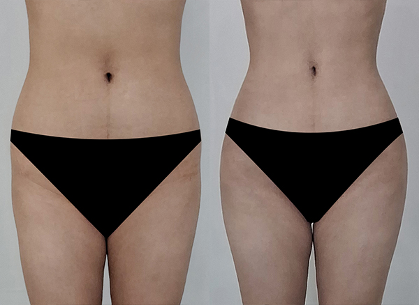 90821425e516db8fe4febe9856dd0016_1767925245_4433.jpg 90821425e516db8fe4febe9856dd0016_1767925245_4433.jpg