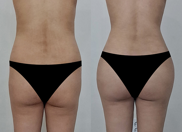 90821425e516db8fe4febe9856dd0016_1767925245_8061.jpg 90821425e516db8fe4febe9856dd0016_1767925245_8061.jpg