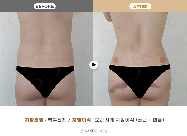 93b2bb5fecd96e7666b238d9e20a1837_1769391852_6746.jpg 93b2bb5fecd96e7666b238d9e20a1837_1769391852_6746.jpg