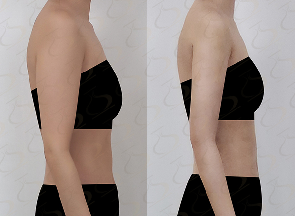 9d8f6a84ef789cadbc12a6ff5ac941fd_1769479603_278.jpg 9d8f6a84ef789cadbc12a6ff5ac941fd_1769479603_278.jpg