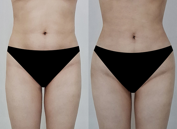 c66245342ea3de3f3bc18884bb8eceff_1767751467_9331.jpg c66245342ea3de3f3bc18884bb8eceff_1767751467_9331.jpg