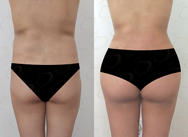 51b2d765e5c3e66c4c48b76859f097ac_1770604826_9401.jpg 51b2d765e5c3e66c4c48b76859f097ac_1770604826_9401.jpg