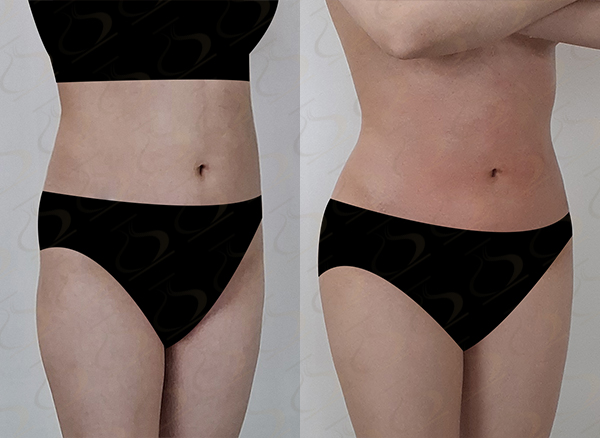 e72f1f1dd04e3767b3414b118b4a9fc2_1770772542_3997.jpg e72f1f1dd04e3767b3414b118b4a9fc2_1770772542_3997.jpg