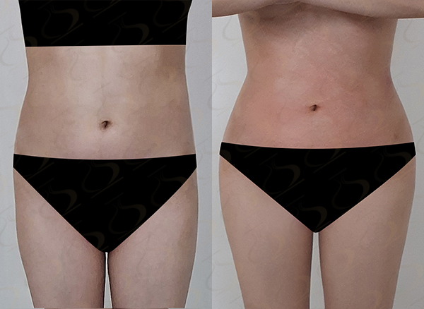 e72f1f1dd04e3767b3414b118b4a9fc2_1770772543_2815.jpg e72f1f1dd04e3767b3414b118b4a9fc2_1770772543_2815.jpg