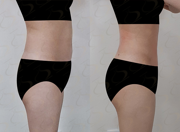 e72f1f1dd04e3767b3414b118b4a9fc2_1770772543_6729.jpg e72f1f1dd04e3767b3414b118b4a9fc2_1770772543_6729.jpg