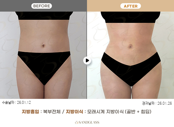 e72f1f1dd04e3767b3414b118b4a9fc2_1770773399_791.jpg e72f1f1dd04e3767b3414b118b4a9fc2_1770773399_791.jpg