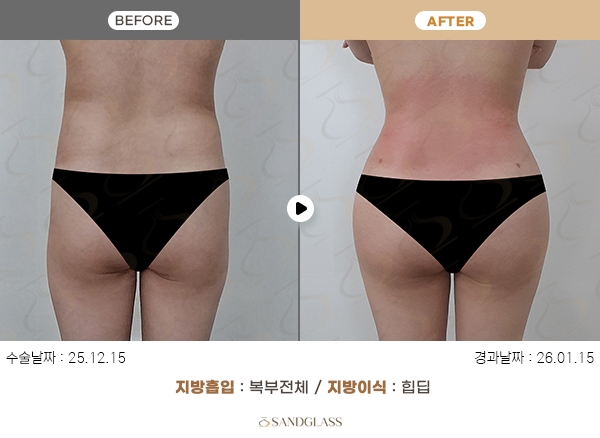 e72f1f1dd04e3767b3414b118b4a9fc2_1770773462_3663.jpg e72f1f1dd04e3767b3414b118b4a9fc2_1770773462_3663.jpg