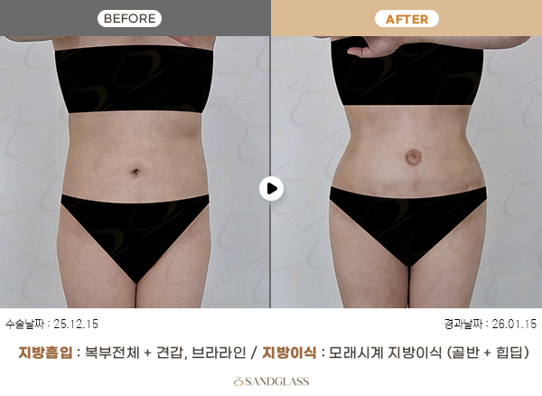 e72f1f1dd04e3767b3414b118b4a9fc2_1770774625_8295.jpg e72f1f1dd04e3767b3414b118b4a9fc2_1770774625_8295.jpg