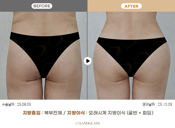 e72f1f1dd04e3767b3414b118b4a9fc2_1770775702_4801.jpg e72f1f1dd04e3767b3414b118b4a9fc2_1770775702_4801.jpg