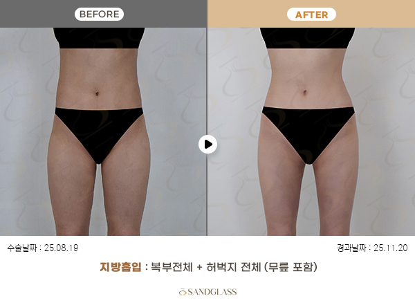 e72f1f1dd04e3767b3414b118b4a9fc2_1770780418_0545.jpg e72f1f1dd04e3767b3414b118b4a9fc2_1770780418_0545.jpg