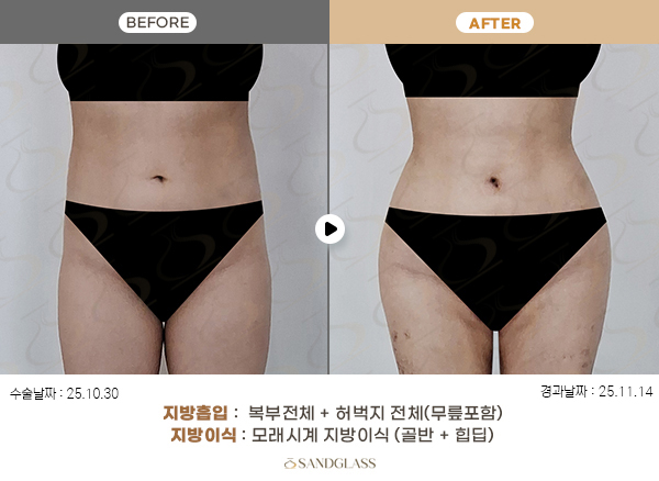 e72f1f1dd04e3767b3414b118b4a9fc2_1770790171_8579.jpg e72f1f1dd04e3767b3414b118b4a9fc2_1770790171_8579.jpg