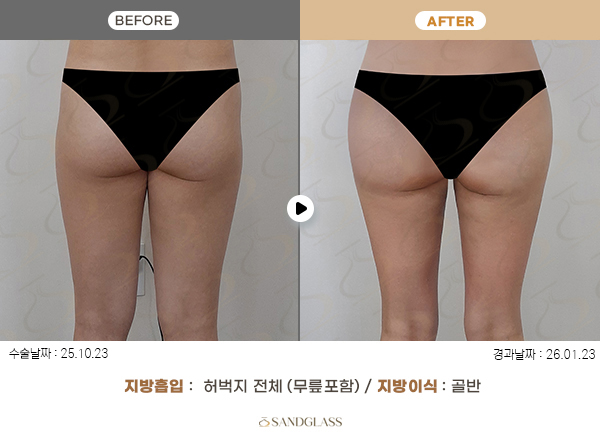 e72f1f1dd04e3767b3414b118b4a9fc2_1770790278_4459.jpg e72f1f1dd04e3767b3414b118b4a9fc2_1770790278_4459.jpg