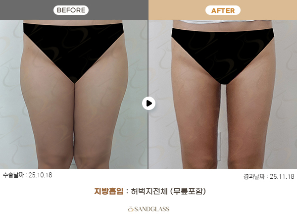 e72f1f1dd04e3767b3414b118b4a9fc2_1770790516_6231.jpg e72f1f1dd04e3767b3414b118b4a9fc2_1770790516_6231.jpg