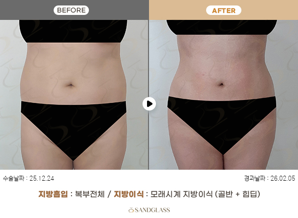 fc12e0cd8e4de85160743993606bd906_1772154771_597.jpg fc12e0cd8e4de85160743993606bd906_1772154771_597.jpg