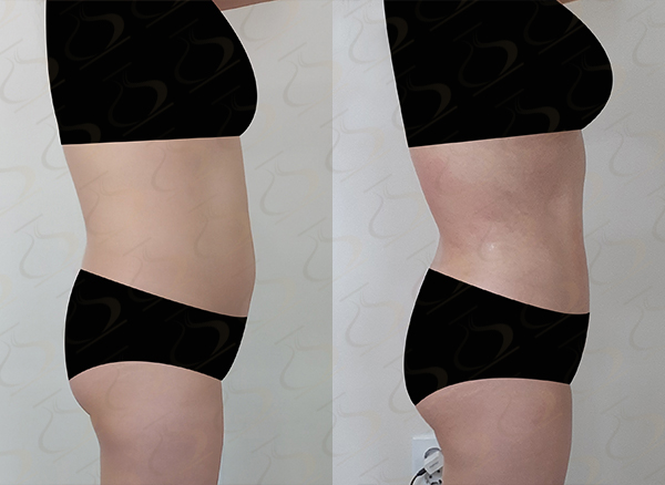 fc12e0cd8e4de85160743993606bd906_1772154771_9737.jpg fc12e0cd8e4de85160743993606bd906_1772154771_9737.jpg