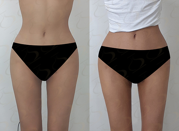 35dc464e5e953204dd2792bb465e059a_1772500050_4347.jpg 35dc464e5e953204dd2792bb465e059a_1772500050_4347.jpg