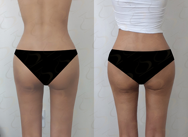 35dc464e5e953204dd2792bb465e059a_1772500050_772.jpg 35dc464e5e953204dd2792bb465e059a_1772500050_772.jpg