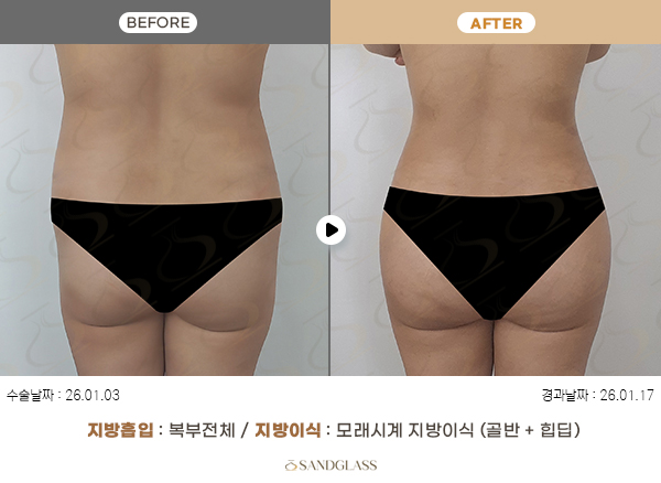 3afbe8a9f65d6b7170aa5439642e1647_1774571517_4699.jpg 3afbe8a9f65d6b7170aa5439642e1647_1774571517_4699.jpg