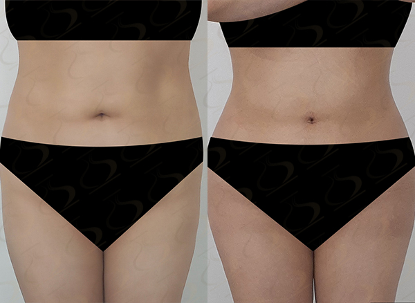 3afbe8a9f65d6b7170aa5439642e1647_1774571517_8297.jpg 3afbe8a9f65d6b7170aa5439642e1647_1774571517_8297.jpg