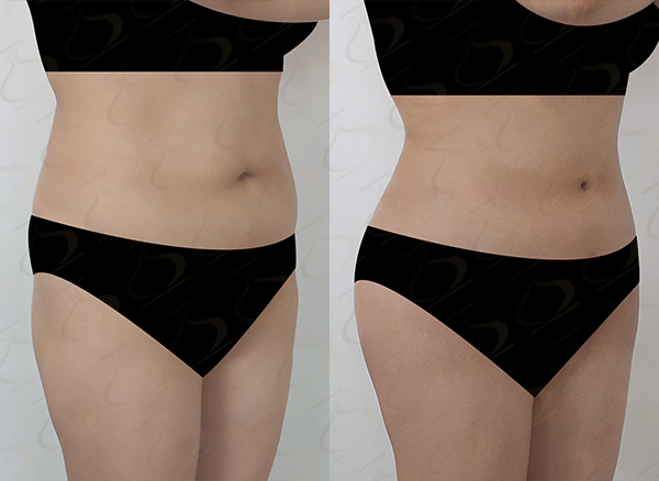 3afbe8a9f65d6b7170aa5439642e1647_1774571518_6061.jpg 3afbe8a9f65d6b7170aa5439642e1647_1774571518_6061.jpg