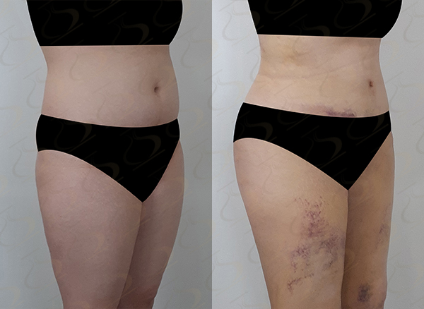 72ad9f0a96e59ea4ba13fa45f417391b_1774835747_7424.jpg 72ad9f0a96e59ea4ba13fa45f417391b_1774835747_7424.jpg