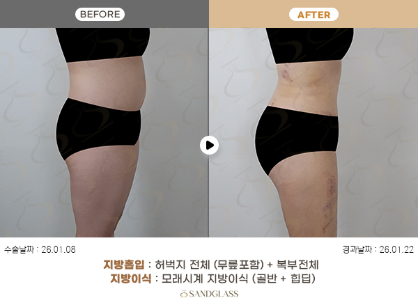 72ad9f0a96e59ea4ba13fa45f417391b_1774835748_1299.jpg 72ad9f0a96e59ea4ba13fa45f417391b_1774835748_1299.jpg