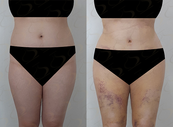 72ad9f0a96e59ea4ba13fa45f417391b_1774835748_4927.jpg 72ad9f0a96e59ea4ba13fa45f417391b_1774835748_4927.jpg