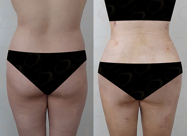 72ad9f0a96e59ea4ba13fa45f417391b_1774835748_8819.jpg 72ad9f0a96e59ea4ba13fa45f417391b_1774835748_8819.jpg