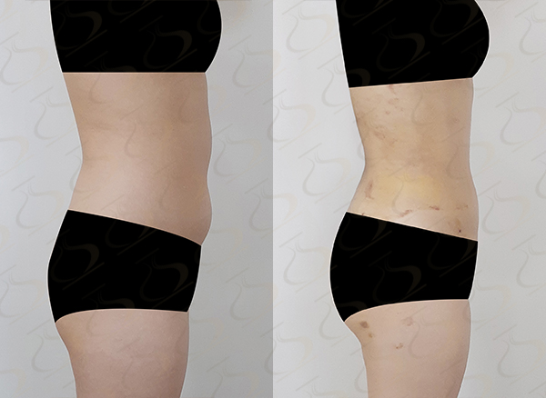 72ad9f0a96e59ea4ba13fa45f417391b_1774835808_6219.jpg 72ad9f0a96e59ea4ba13fa45f417391b_1774835808_6219.jpg