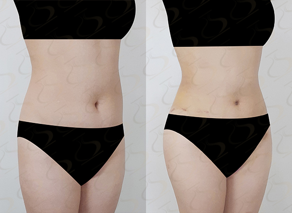 72ad9f0a96e59ea4ba13fa45f417391b_1774835809_3485.jpg 72ad9f0a96e59ea4ba13fa45f417391b_1774835809_3485.jpg