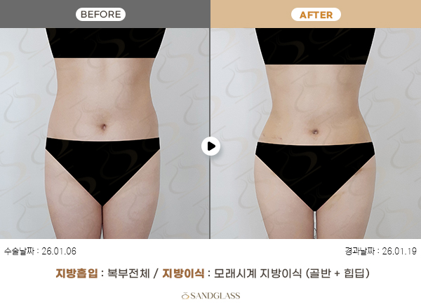 72ad9f0a96e59ea4ba13fa45f417391b_1774835809_7506.jpg 72ad9f0a96e59ea4ba13fa45f417391b_1774835809_7506.jpg