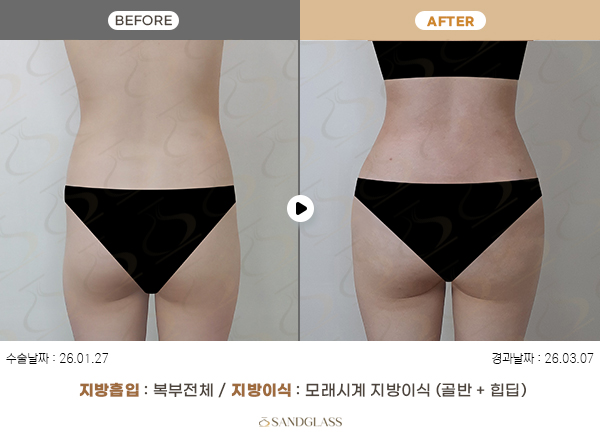 754a362fb44a033d6f9cee3597e2cb66_1773883708_4284.jpg 754a362fb44a033d6f9cee3597e2cb66_1773883708_4284.jpg