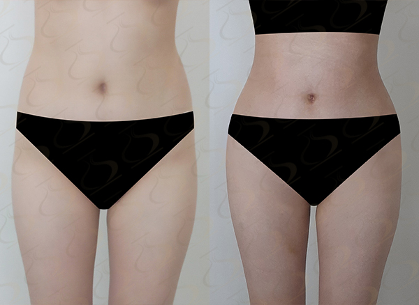 754a362fb44a033d6f9cee3597e2cb66_1773883708_8358.jpg 754a362fb44a033d6f9cee3597e2cb66_1773883708_8358.jpg