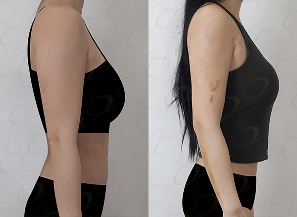 cdb33612bccf64bba0a4a6f9455eaefb_1773020161_6601.jpg cdb33612bccf64bba0a4a6f9455eaefb_1773020161_6601.jpg