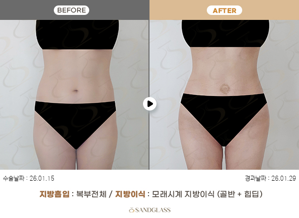 ff6a22eb15f81d7c876ce8dac2ad364c_1774918712_6947.jpg ff6a22eb15f81d7c876ce8dac2ad364c_1774918712_6947.jpg